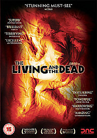The living and dead - living,